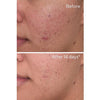 Rapid Dark Spot Correcting Serum - USTRADA