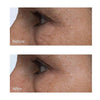 Cold Plasma Plus+ Advanced Eye Cream - USTRADA