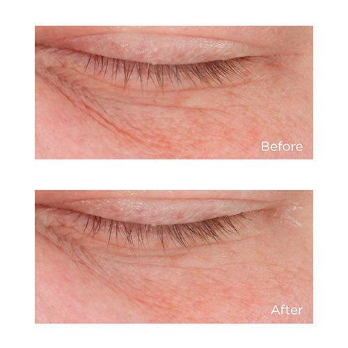 Cold Plasma Plus+ Advanced Eye Cream - USTRADA